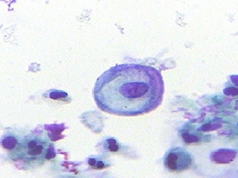 citopatologia-celula citopatologia-celula